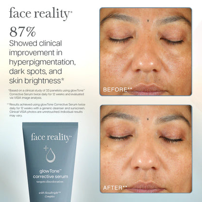 GLOWTONE™ CORRECTIVE SERUM