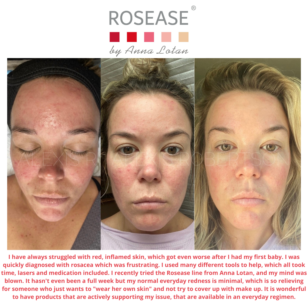 Calm & Cool Daily Moisturizer 2.4fl oz